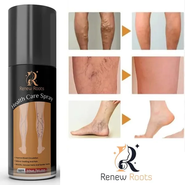 Natural_Herbal_Varicose_Pain_Relief_Oil|_Fast_Action_Formula_For_Leg,_Nerve_&_Vein_Pain_(30_Ml)