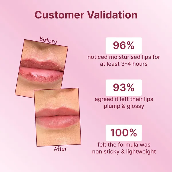 Natural_Lip_Balm_For_Soft_&_Moisturized_Lips_(5_Gm)