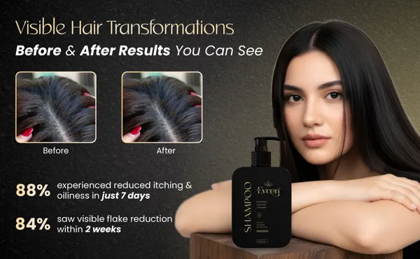 Scalp_Bloom_Shampoo_For_Unisex