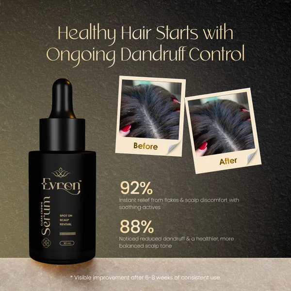Spot_On_Scalp_Revival_For_Unisex
