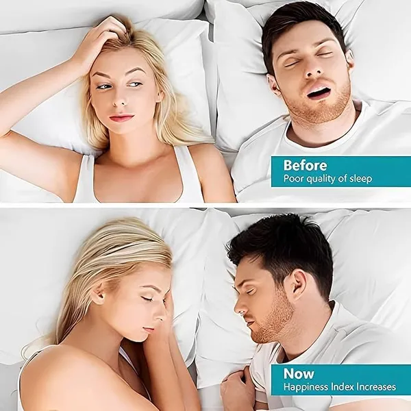 KROYWEN_Anti_Snoring_Nose_Clip_Devices_for_Men_and_Women,_Snoring_stopper,_Snore_Free_Magnetic_Nose_Clip,_Snoring_Solution,Silicone_Magnetic_Nose_Clip_Pack_of_2