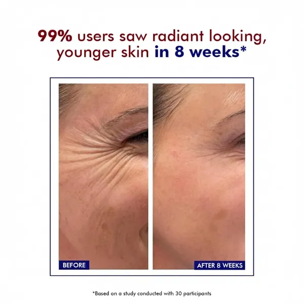 DeeperDots_Retinol_Ceramide_Skin_Barrier_Repair_Cream