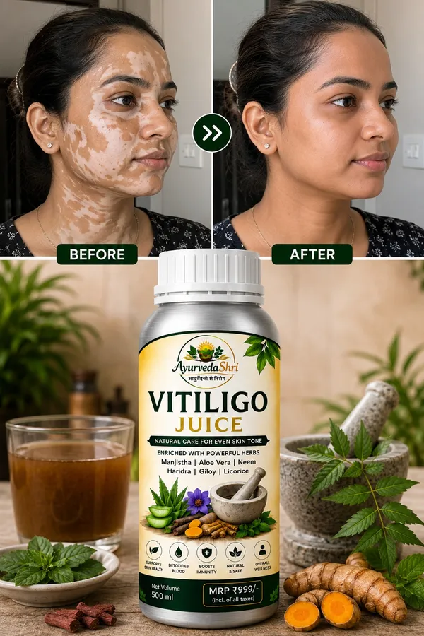 Go_Vitiligo_Juice_-_Natural_Care_For_Even_Skin_Tone