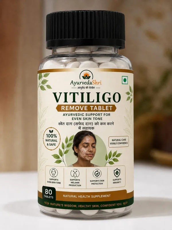 Vitiligo_Remove_Capsule_-__Ayurvedic_Support_Even__Skin_Tone