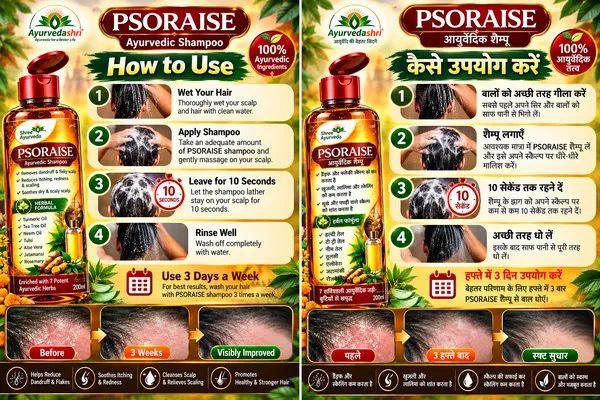 Scalp_Psoriasis_Sufferers_Psoriasis_Care_Shampoo_buy_one_get_one