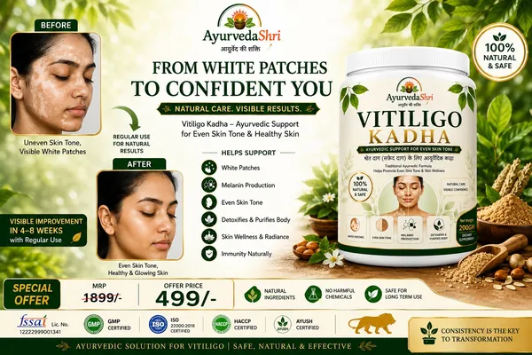 VITILIGO_KADHA-NATURAL_CARE_VISIBLE_CONFIDENCE