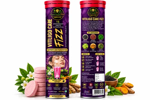 Vitiligo_Care_Fizz_