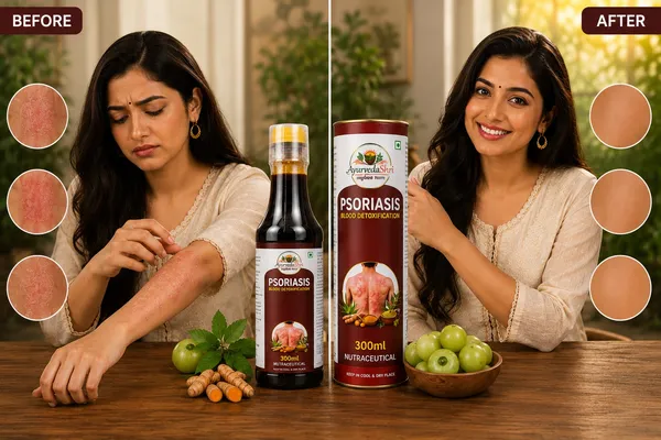 Psoriasis_Detox_Herbal_Juice_300+300_ml