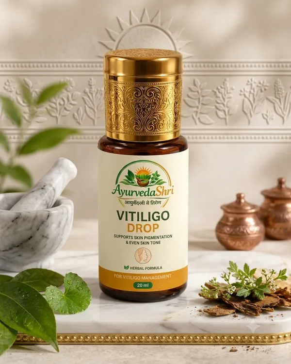 Vitiligo_Drop