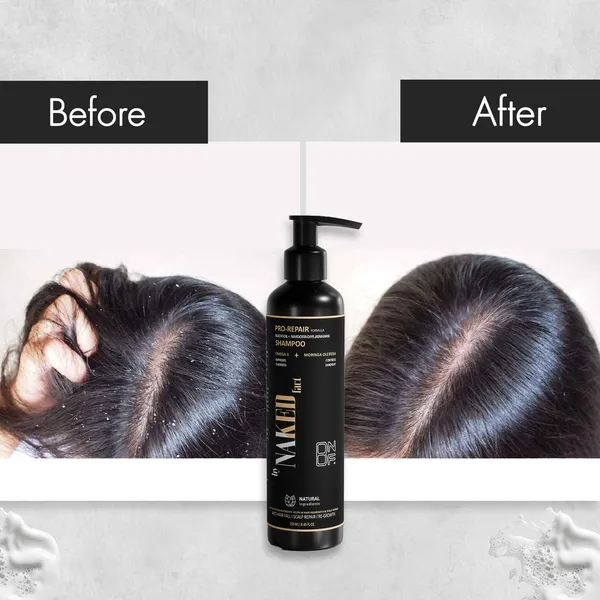 By_Naked_Fact_Pro_Repair_Anti_Hairfall_Black_Soil_Shampoo_5X_Hair_Fall_Control_Scalp_Cleaning_And_Strengthening_Contains_Nardostachys_Jatamansi,_Omega_3_And_Moringa_Oleifera_For_All_Hair_Types_For_Women_And_Men_250Ml
