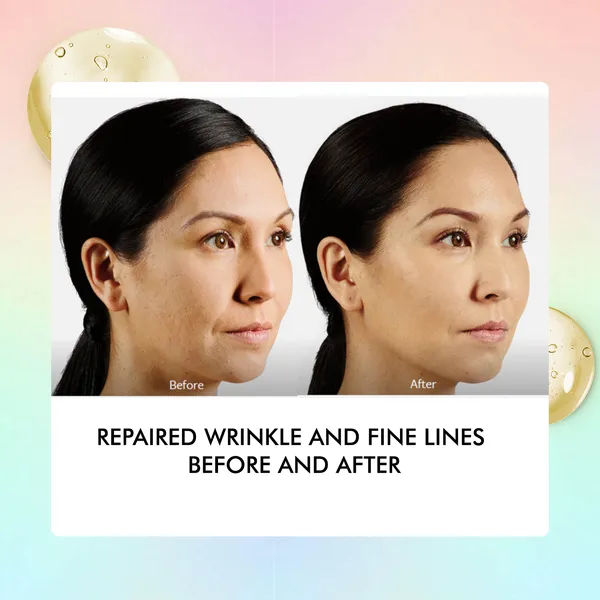 By_Naked_Fact_Anti_Ageing_Serum_For_Face_With_Argireline,_Niacinamide,_Vitamin_E_And_Squalene_Boosts_Collagen_Reduces_Fine_Lines_And_Wrinkles_Dark_Spot_Corrector_Uv_Protection_Fights_Signs_Of_Ageing_For_Mature,_Combination_And_Dry_Skin_30Ml
