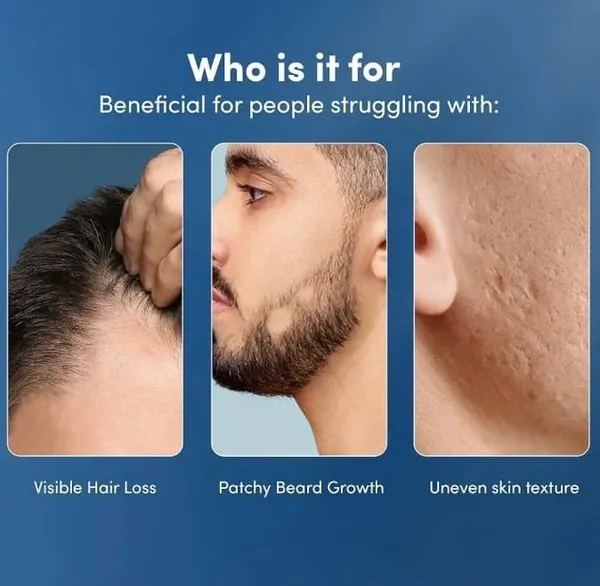 Black_Polyester_Premium_Hair_Growth_And_Reduces_Acne_Scars_For_Hair_Growth,_Reduces_Acne_&_Scars