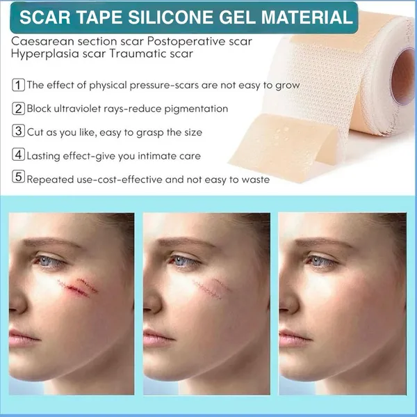 Brown_Silicone_Premium_Scar_Remover_Tape_For_Scars,_Fine_Lines