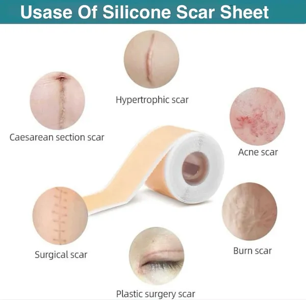 Brown_Silicone_Premium_Scar_Remover_Tape_For_Scars,_Fine_Lines