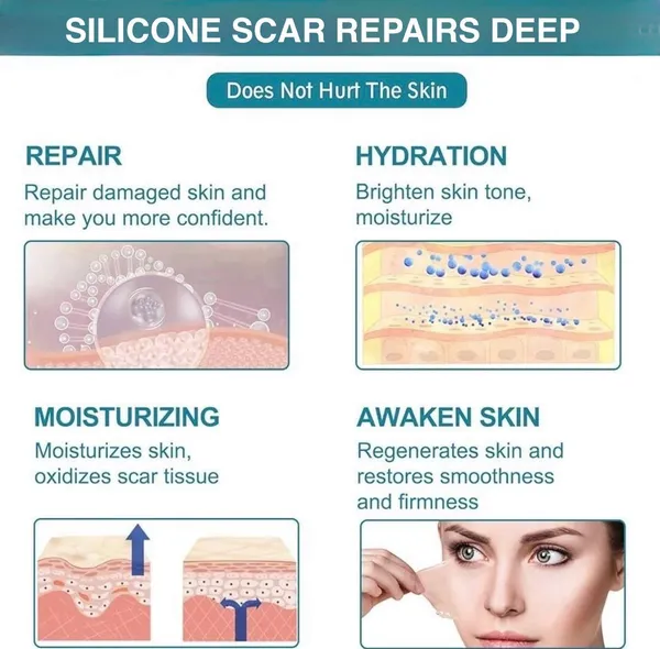 Brown_Silicone_Premium_Scar_Remover_Tape_For_Scars,_Fine_Lines