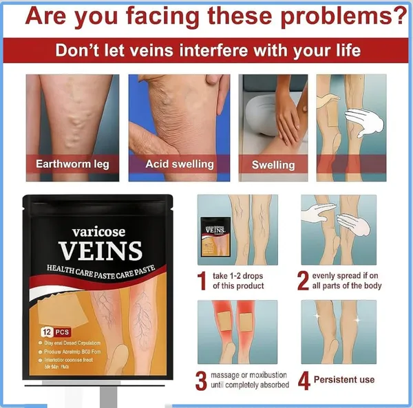 Yellow_Cotton_Premium_Varicose_Veins_Relief_Patches_For_Varicose_Veins