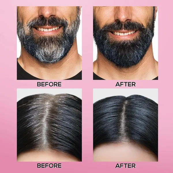 Korean_Hair_Powder_-_Black_|_Covers_Grey_Roots_&_Bald_Spots_Instantly_|_Highly_Pigmented_Flawless_Hair_Density_Filler
