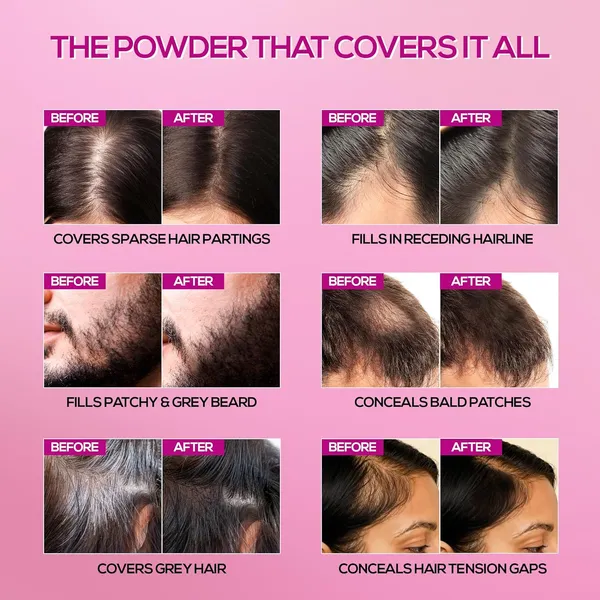 Korean_Hair_Powder_-_Black_|_Covers_Grey_Roots_&_Bald_Spots_Instantly_|_Highly_Pigmented_Flawless_Hair_Density_Filler