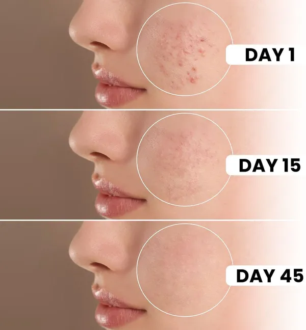 6IN1_Expert_Facewash_-__(100ml)