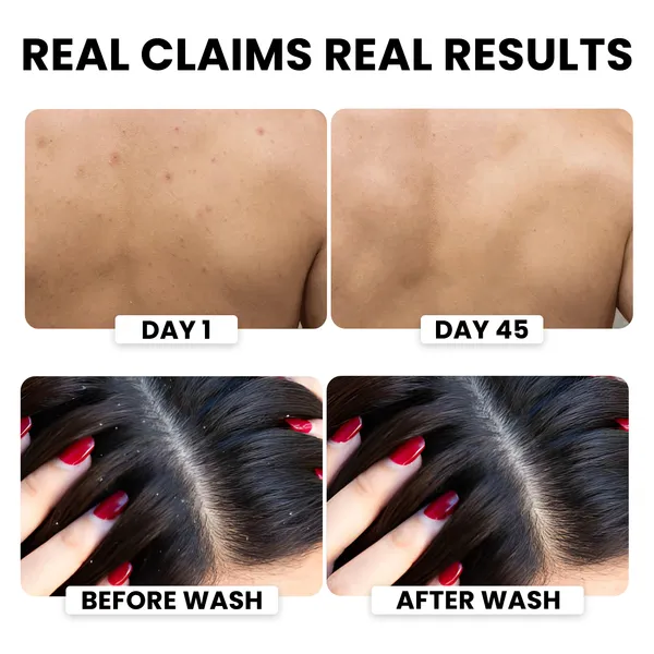 Desire_Alpha_Total_Clean_Duo_(Pack_of_2)_6-in-1_Expert_Face_Wash_100ml_+_Hair_&_Body_Wash_300ml