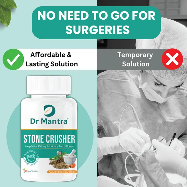 Dr_Mantra_Stone_Crusher_Capsule