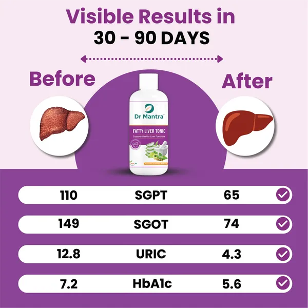 Dr_Mantra_Fatty_Liver_Tonic