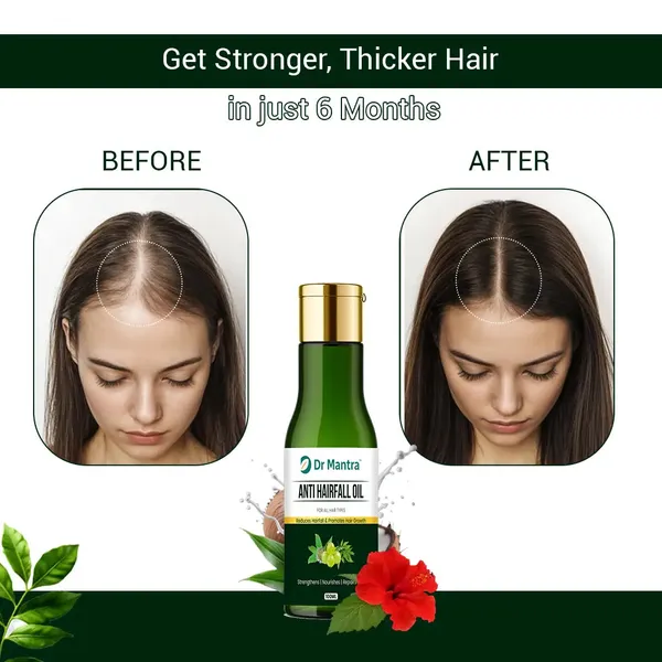 Dr_Mantra_Anti_Hair_For_Oil_|_100_ml