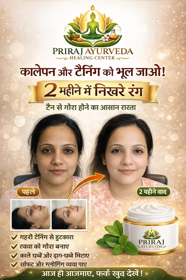 White_Priraj_Ayurveda_Anti_Tan_&_Dark_Spot_Removal_Face_Cream_For_Skin_Brightening_&_Pigmentation_Treatment