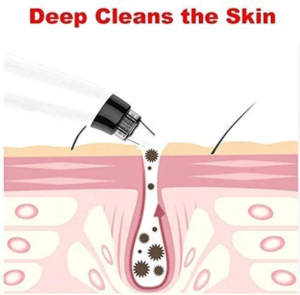 Blue_Pure_Nest_Pore_Cleaning_Device_Electric_Head_Remover_Vacuum_With_4_Interchangeable_Suction_Heads