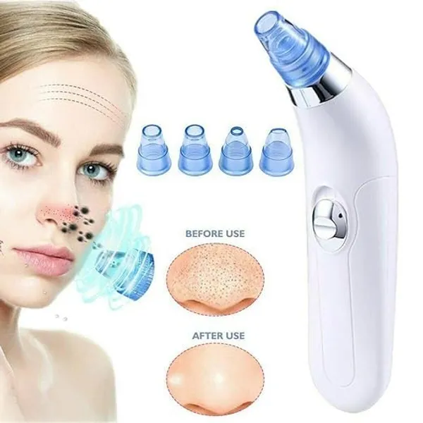 Blue_Pure_Nest_Pore_Cleaning_Device_Electric_Head_Remover_Vacuum_With_4_Interchangeable_Suction_Heads