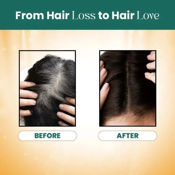 Glow_Meast_Roots_Hair_Growth_Shampoo_100_Ml