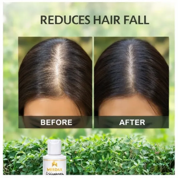 Meedax_Hair_Fall_Control_Conditioner