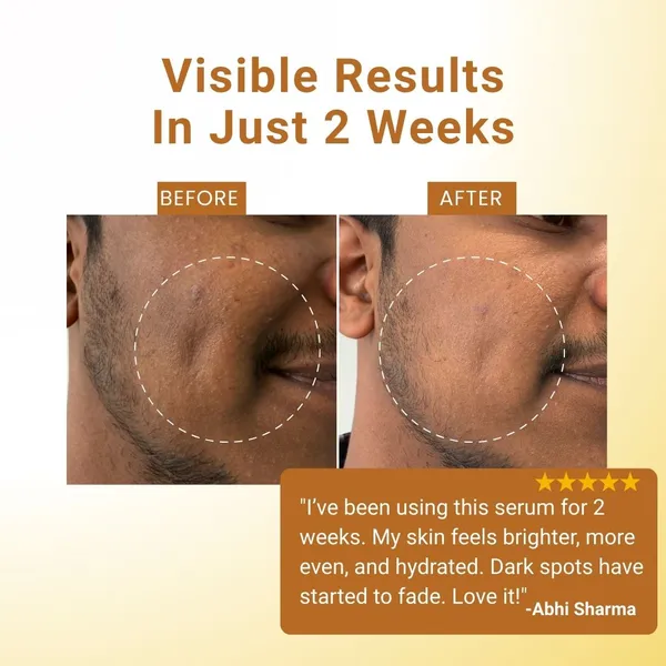 Advance_10%_Vitamin_C_Serum_For_Skin_Brightening,_Uv_Damage,_Dark_Spots_&_Glow(Stable)_|Smooth_&_Youthful_Skin_30_Ml