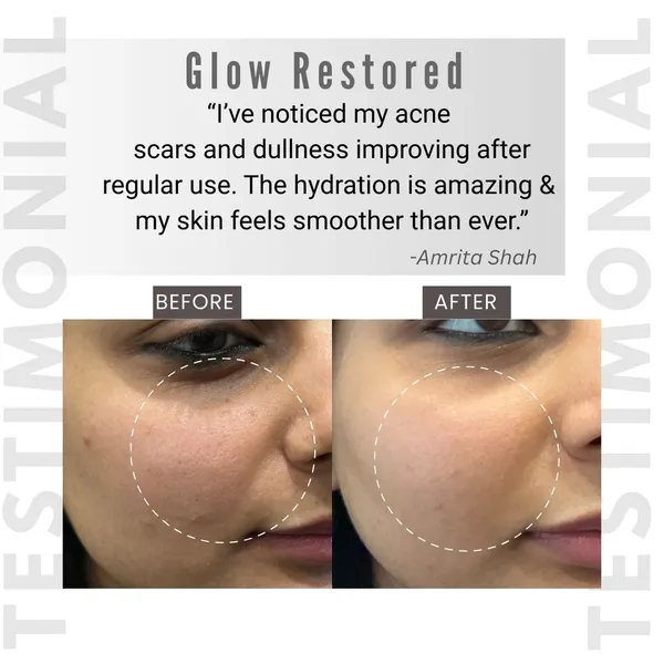 Certified_Ultra_96_Snail_Mucin_Face_Serum_For_Glowing,_Brightening,_Hydrating_Skin_&_Wrinkle_Reduction