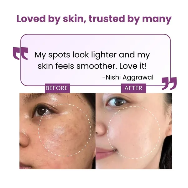 Alpha_Arbutin_Serum_2%_For_Brightening,_Pigmentation_&_Dark_Spot_Removal_|_Smooth_&_Youthful_Skin