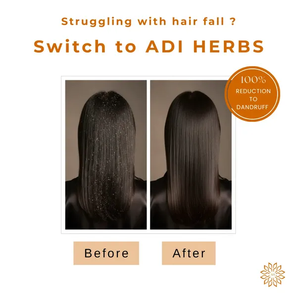 Onion_Tea_Tree_Anti_Dandruff_Shampoo