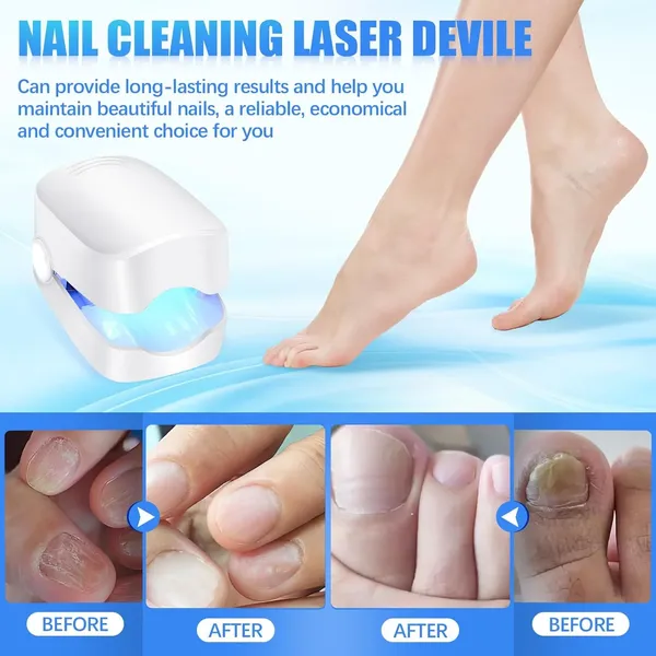 Genetelle_Nail_Cleansing_Laser_Device