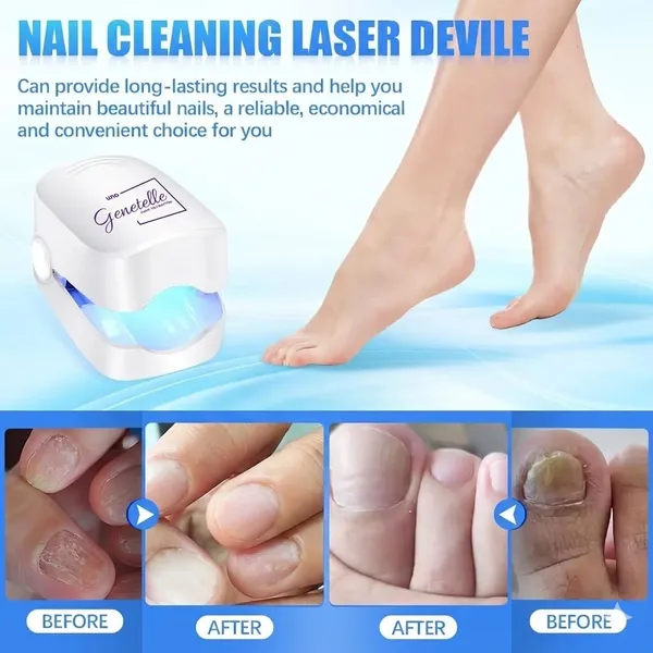 Genetelle_Nail_Cleansing_Laser_Device