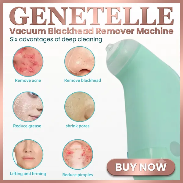 Genetelle_Vacuum_Blackhead_Remover_Machine