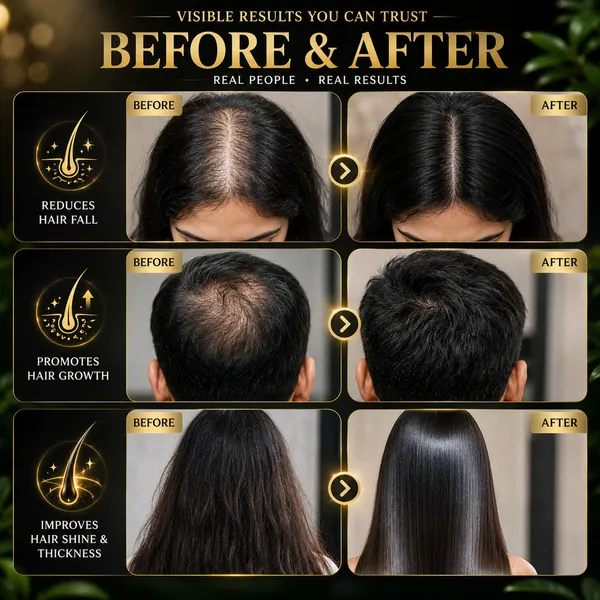 Faran_Herbals_Complete_Hair_Care_Combo_–_Hair_Fall_Control,_Hair_Growth_&_Scalp_Nourishment