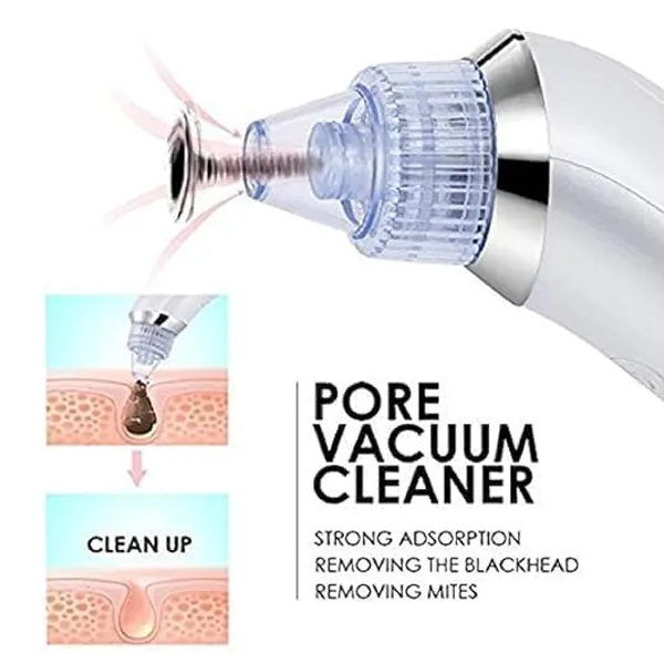 White_Plastic_4_In_1_Blackhead_Remover_Vacuum_Usb_Rechargeable_For_Skin_Care