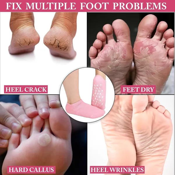 Pink_Silicone_Reusable_Spa_Gel_Socks_1_Pair_For_Women_Men_Heel_Care