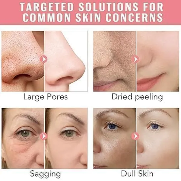 White_Hydrogel_Overnight_Face_Mask_34_G_With_Niacinamide_Vitamin_E_Centella_For_Skin_Care