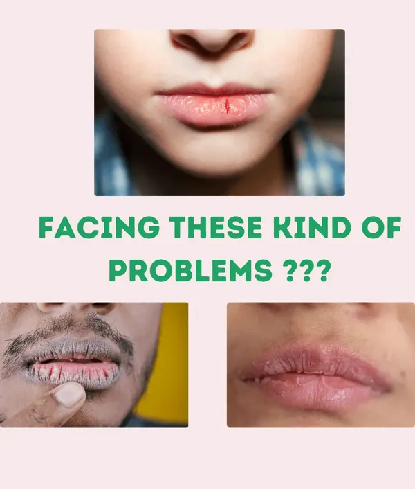 Kayapalat_Mud_Lips_Lip_Balm_For_Pigmented_Lips