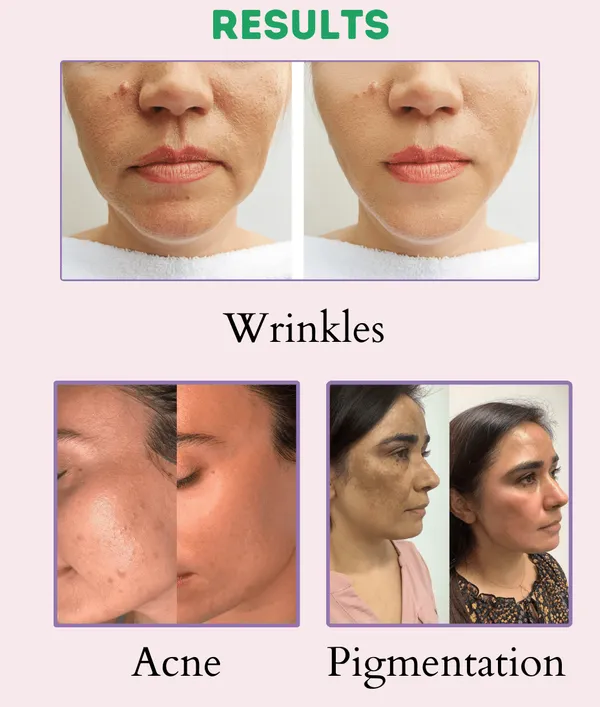 Multi_Purpose_Cream_Your_Ultimate_Skincare_Solution