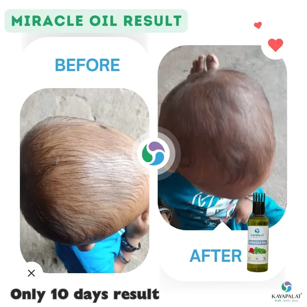 Miracle_Hair_Oil_Restore_Damaged_Hair_Strengthen_Roots_Naturally