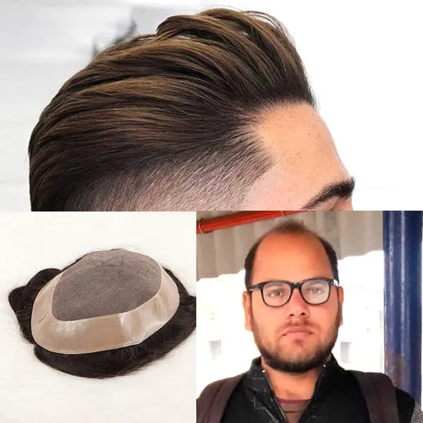 Men_S_Human_Hair_Replacement_System