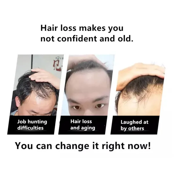 Men_S_Hairline_Toupee