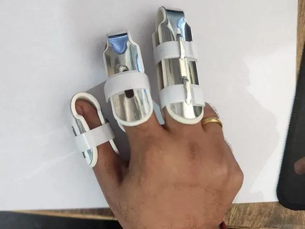 Aluminum_Alloy_Finger_Splint