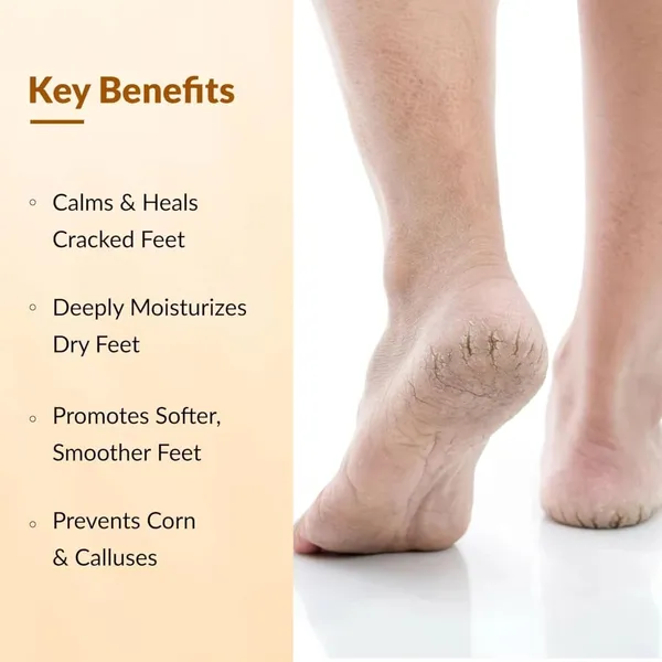 Foot_Cream_For_Dry_Cracked_Feet_Urea_Lactic_Acid_Treatment_Heals_Cracked_Heels_Calluses_Moisturizing_Repair_Cream_50G